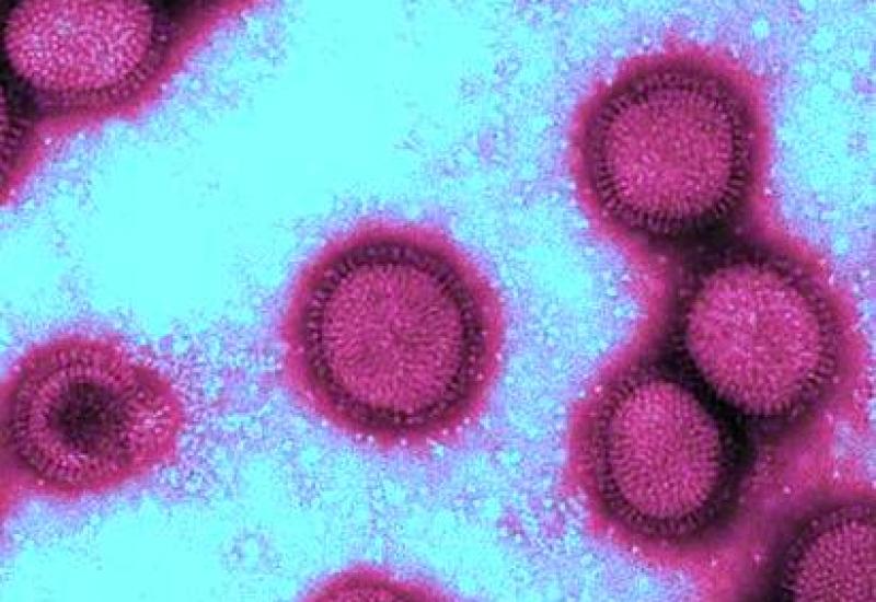 Вірус високопатогенного грипу А (Н1N1)