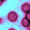 Вірус високопатогенного грипу А (Н1N1)